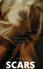 Scars (hardcopy)